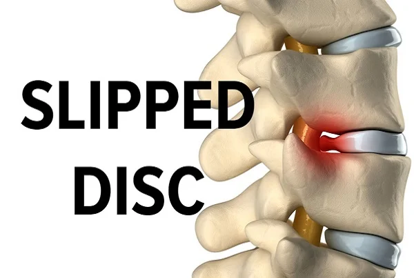 Slip-Disc